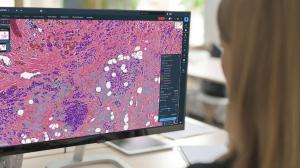 Techcyte and Aignostics launch AI-guided tumor selection for NGS prep